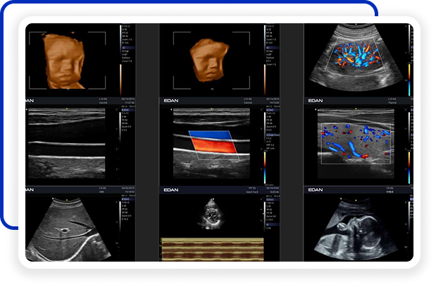 Imagem de Alta Resolução
