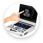 Touch screen HD de 15